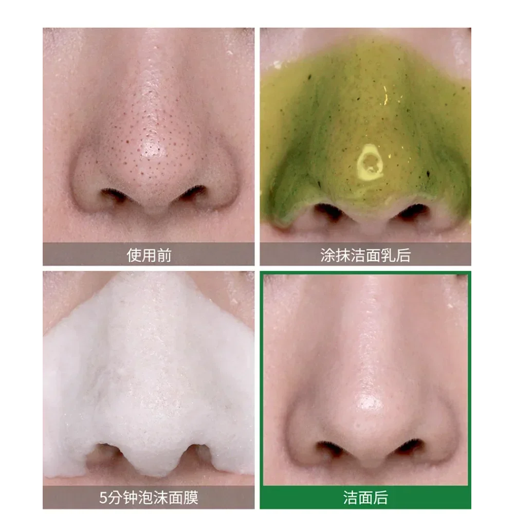 เกาหลี SOME BY MI Bye Bye Blac - Skincare Some By Mi บทวิจารณ์และราคา