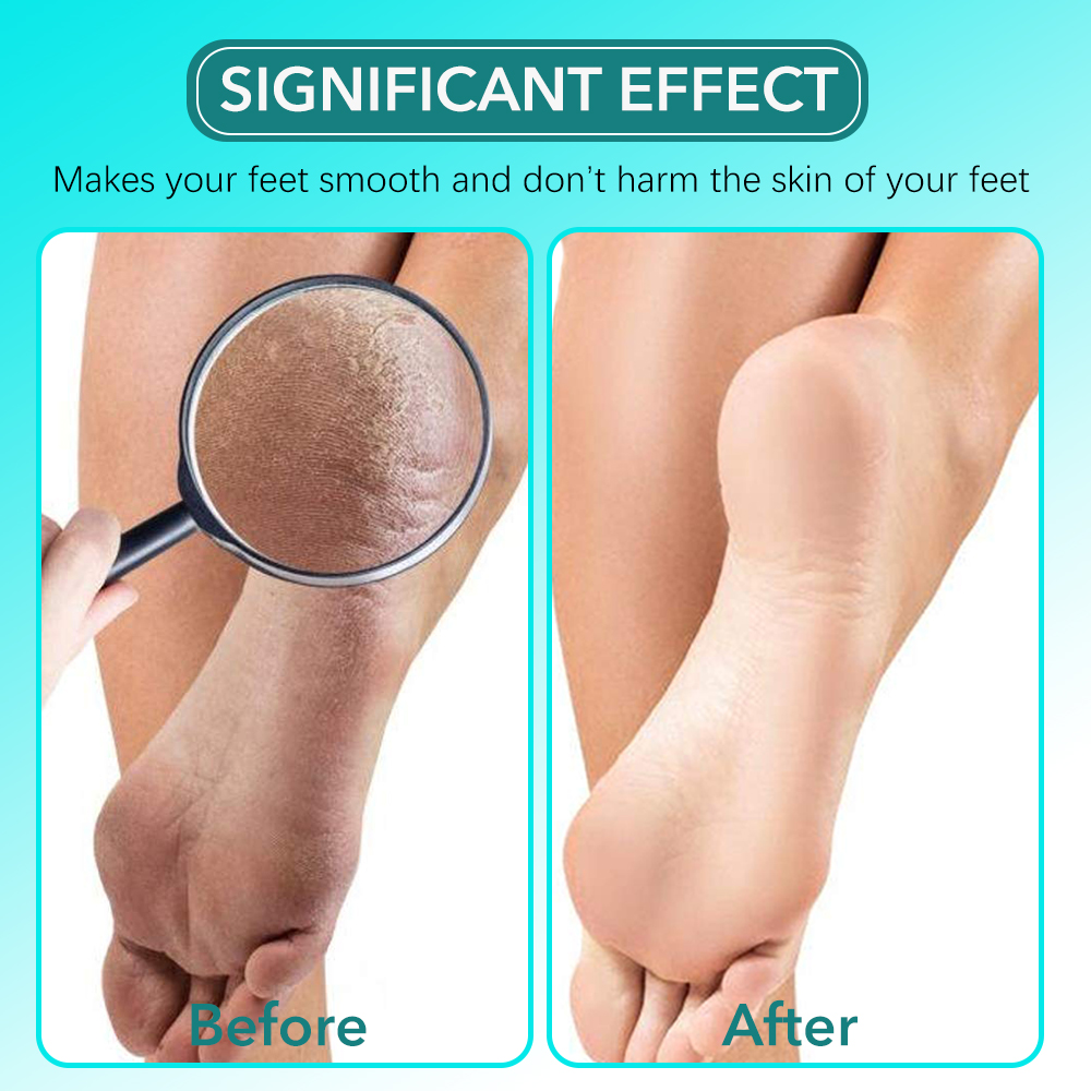 ชุดตะไบเท้าแก้ว 2 ชิ้น/ชุด สำห - Skincare Ingredients Checker บทวิจารณ์และราคา