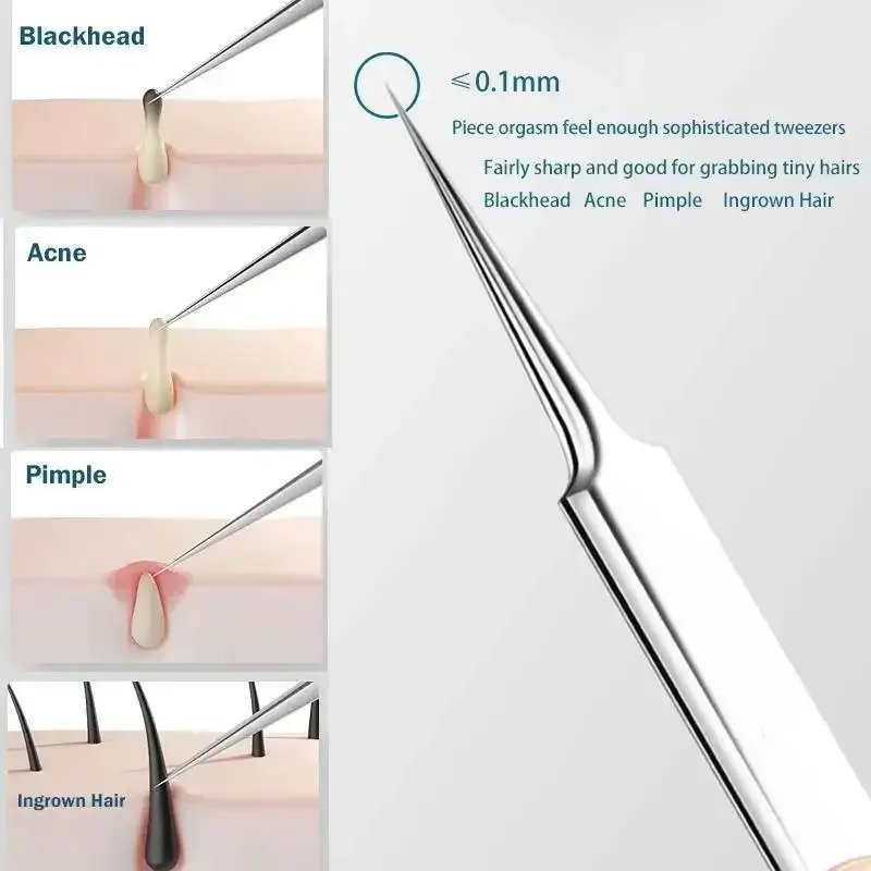 11 ชิ้น/เซ็ตเข็มสิว Blackhead  - Skincare Ingredients Checker บทวิจารณ์และราคา